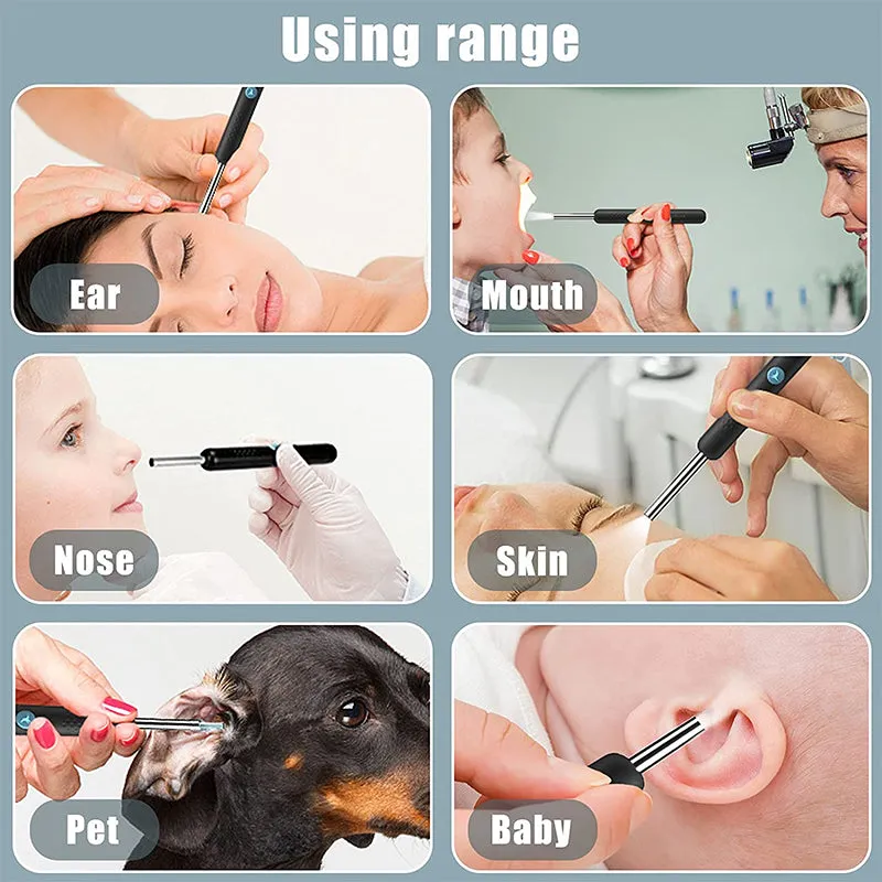 Smart Visual Ear Sticks Endoscope 300w High Precision Earpick
