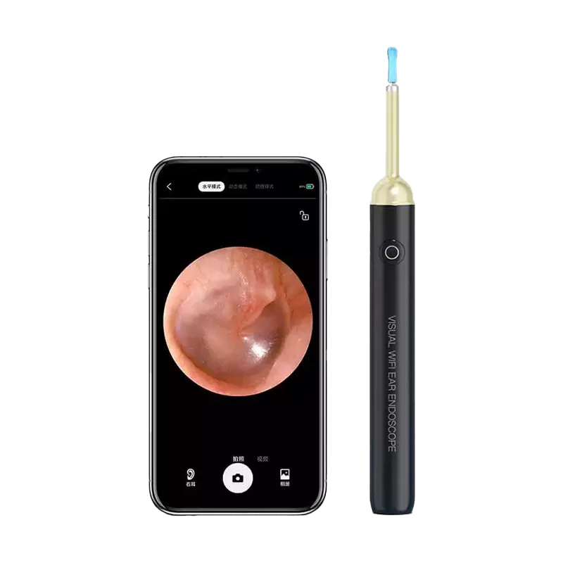 SUNUO Find S Smart Visual Ear Cleaner